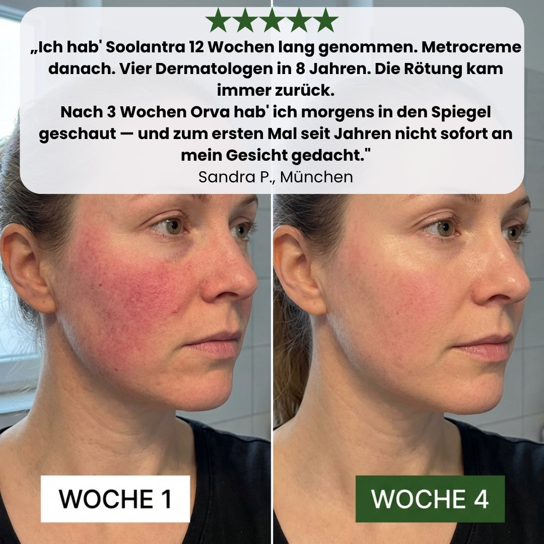 Orva Anti-Rötungen Serum