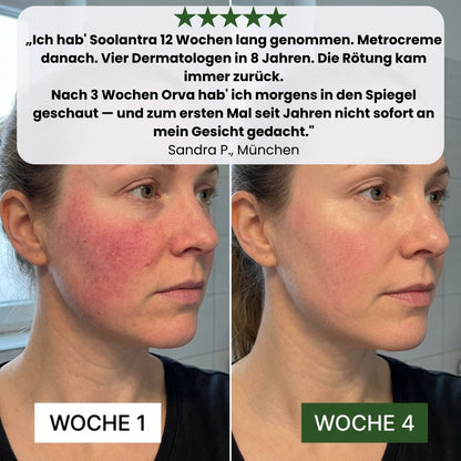 Orva Anti-Rötungen Serum