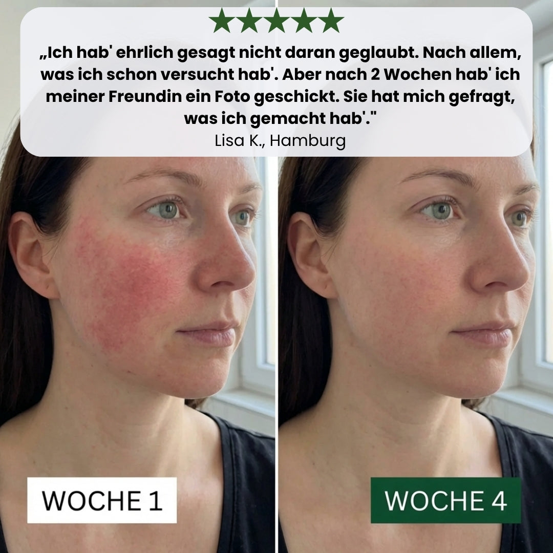 Orva Anti-Rötungen Serum