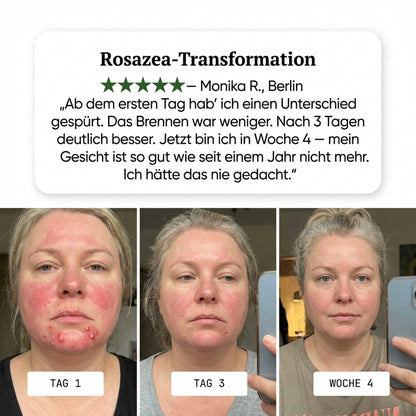 Orva Anti-Rötungen Serum