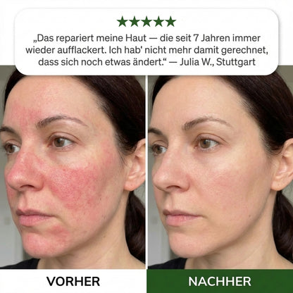 Orva Anti-Rötungen Serum